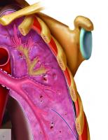 Specialty Imaging: HRCT of the Lung
 032352477X, 9780323524773