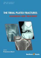 The Tibial Plateau Fractures: Diagnosis and Treatment [1 ed.]
 9781681082417, 9781681082424